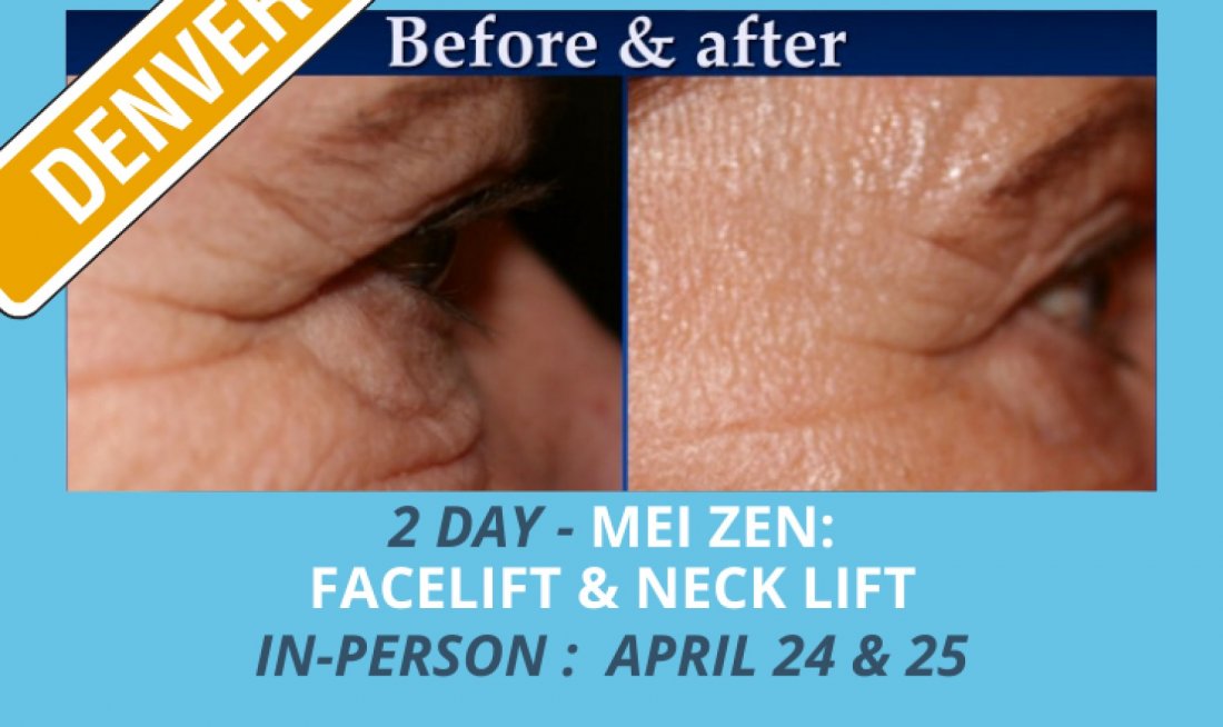 Cosmetic Acupuncture Facelift and Neck/Jowls Lift LIVE [Denver, CO